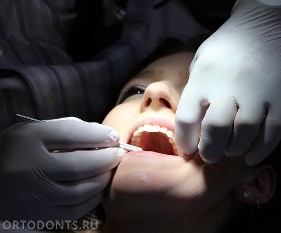 Фото публикации: Санация зубов. Лечение перед установкой брекет-системы