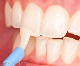Фото публикации: Глубокое фторирование эмали зубов - защита от кариеса