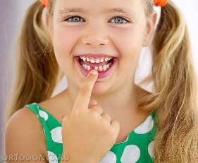 Фото статьи: Детские зубы. Молочный прикус. Лечим детям зубы. Как научить ребёнка гигиене зубов. Родителям на заметку.